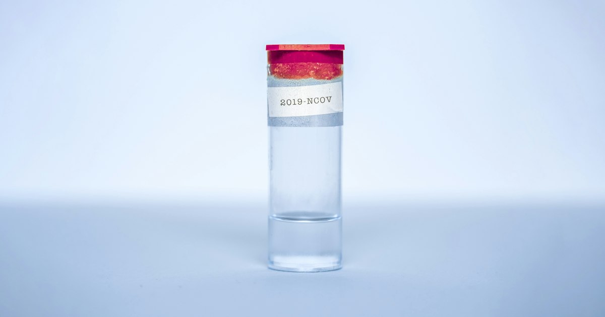 Potassium and sodium above or below normal: causes in athletes and what to do